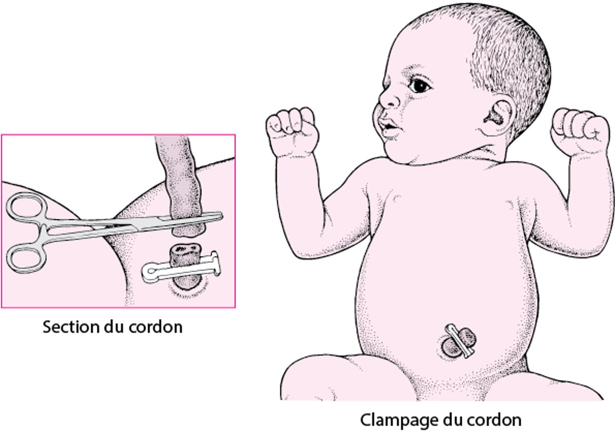 Section du cordon ombilical