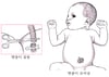 탯줄 절단