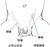 停留精巣