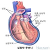 심장막 주머니