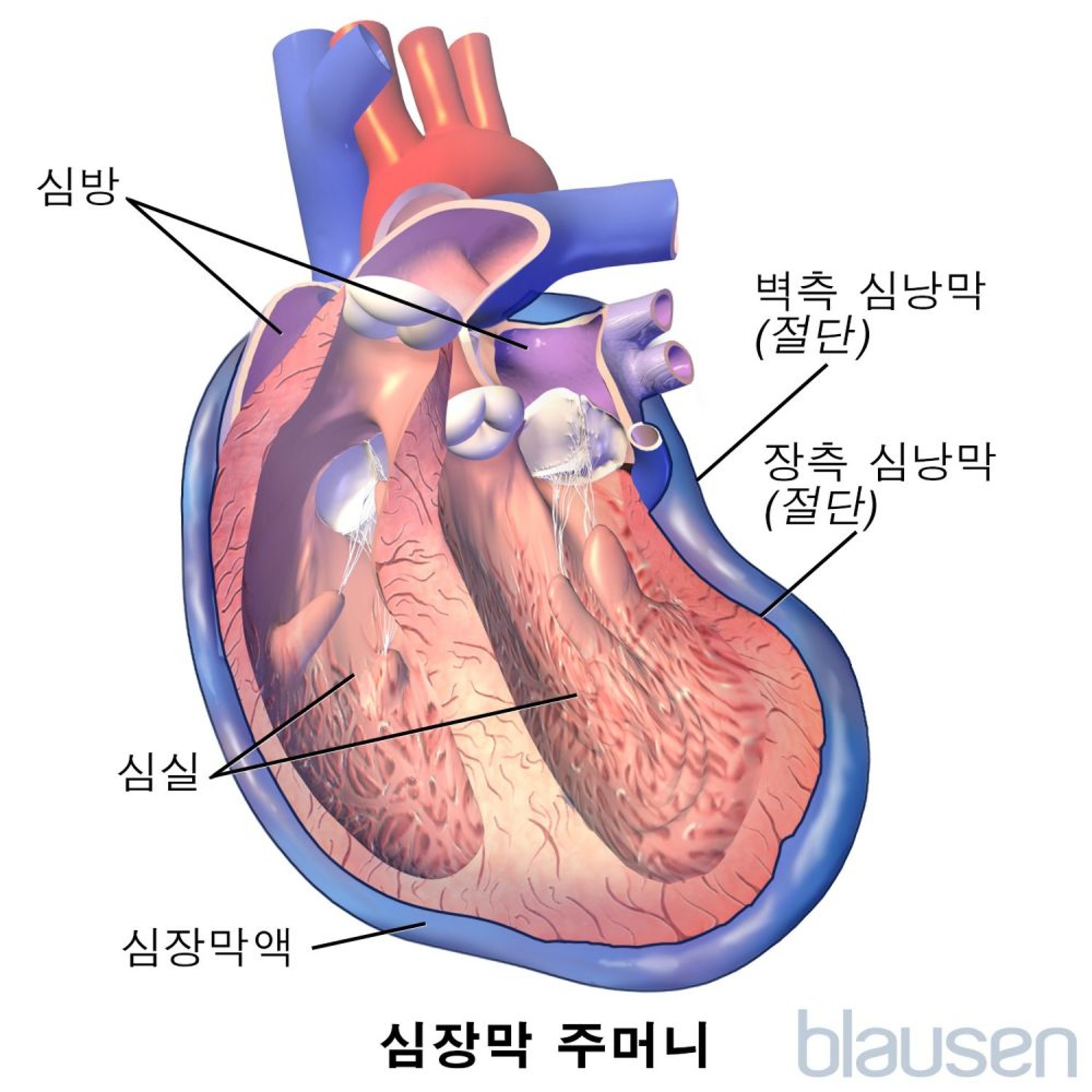 심장막 주머니