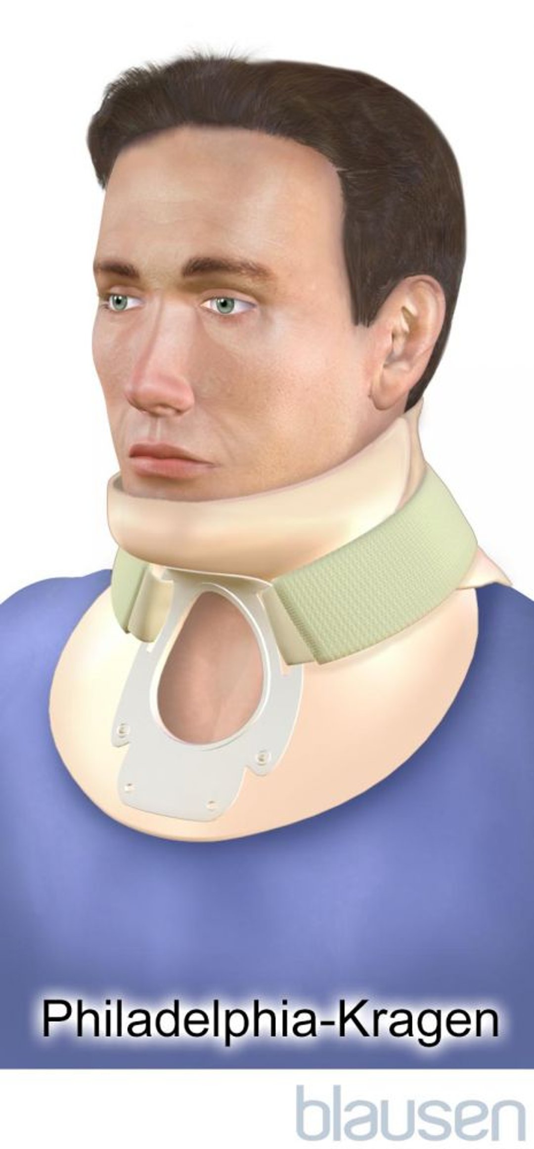 Philadelphia-Halskrause