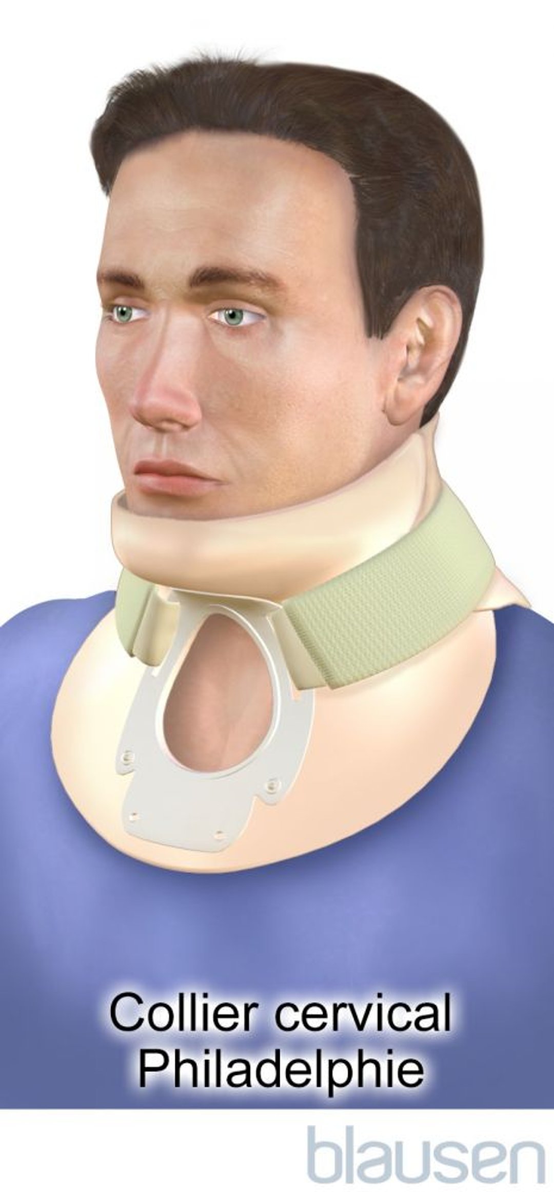 Collier cervical Philadelphie
