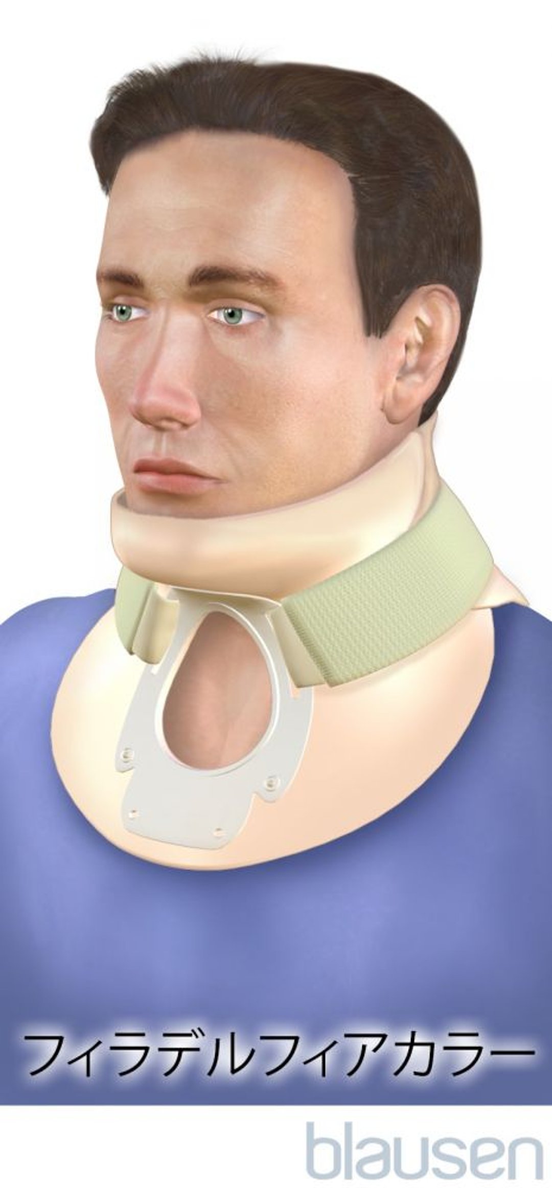 フィラデルフィアカラー