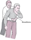 Performing Abdominal Thrusts (Heimlich Maneuver)