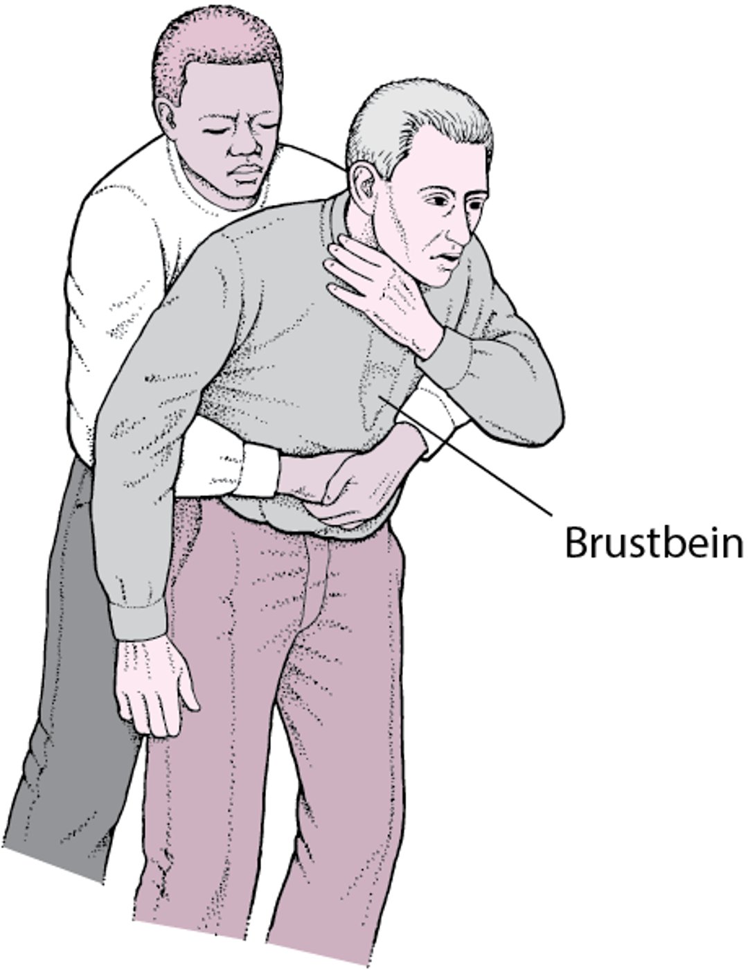 Durchführung von Druckstößen in Richtung Zwerchfell (Heimlich-Handgriff)