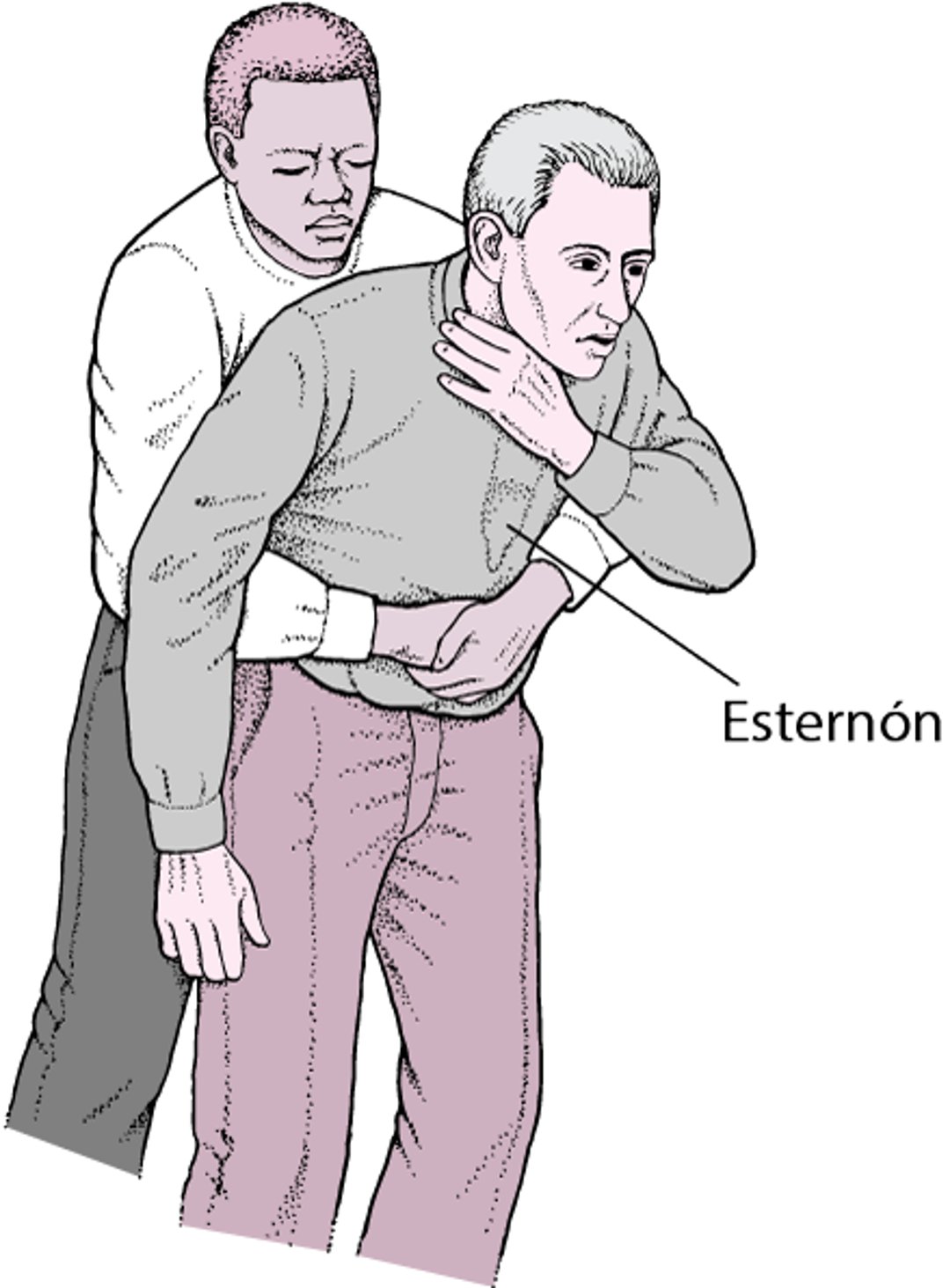 Realización de compresiones abdominales (maniobra de Heimlich)