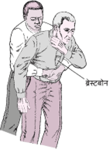 पेट पर जोर देना (हाइमलिख मनुवर)