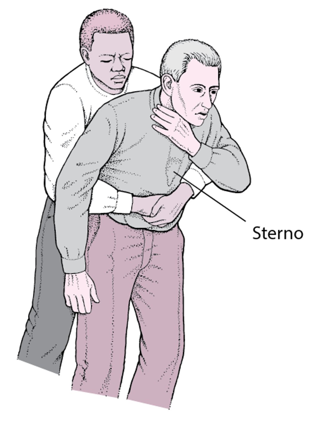 Esecuzione di spinte addominali (manovra di Heimlich)