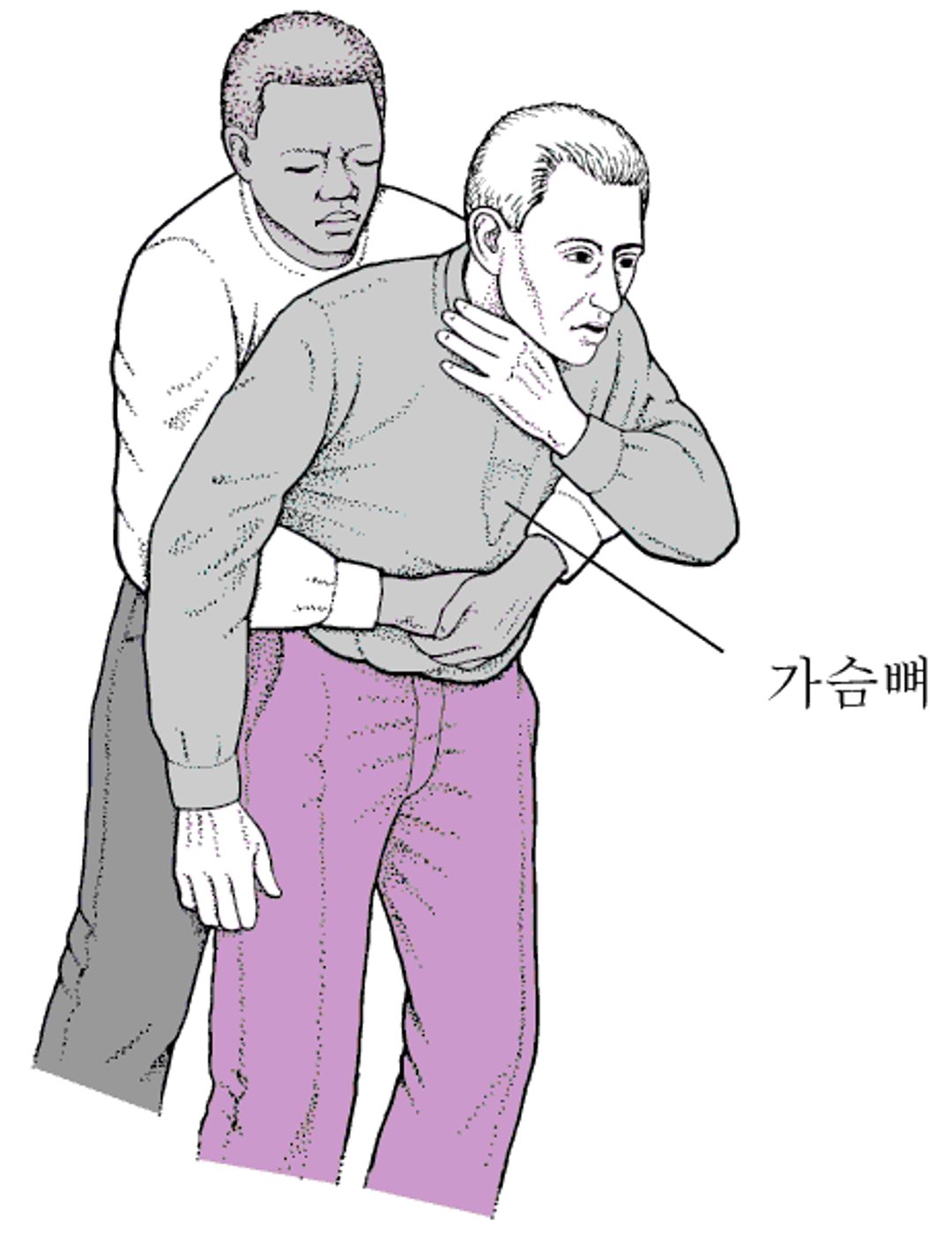 복부 밀어내기(하임리크 구명법) 실시