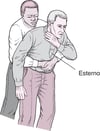 Realização de compressões abdominais (manobra de Heimlich)