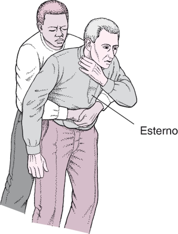 Realização de compressões abdominais (manobra de Heimlich)