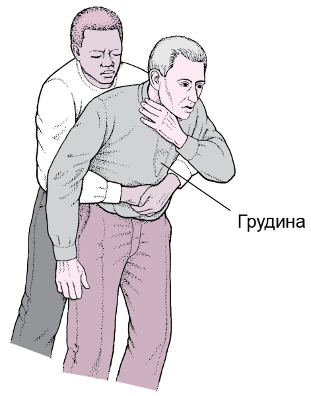 Выполнение абдоминальных толчков (приема Хеймлиха)