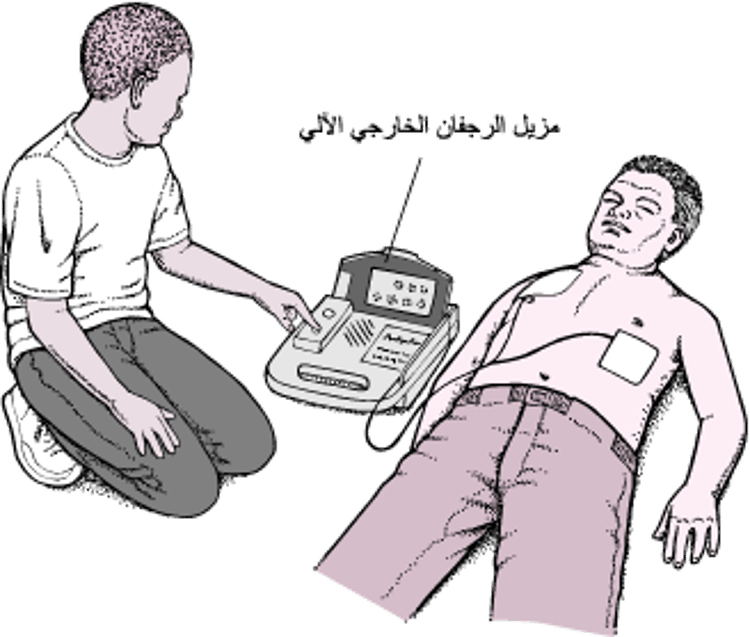 مُزيل الرَّجفان الخارجي الآلي: استعادة النظم القلبي الطبيعي