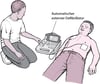 Automatischer externer Defibrillator: Fremdstarten des Herzens