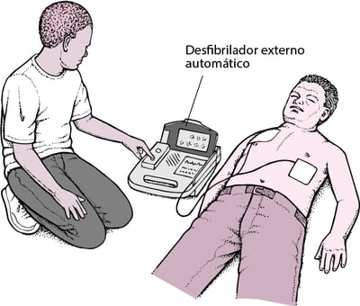 Desfibrilador externo automático: poner en marcha el corazón