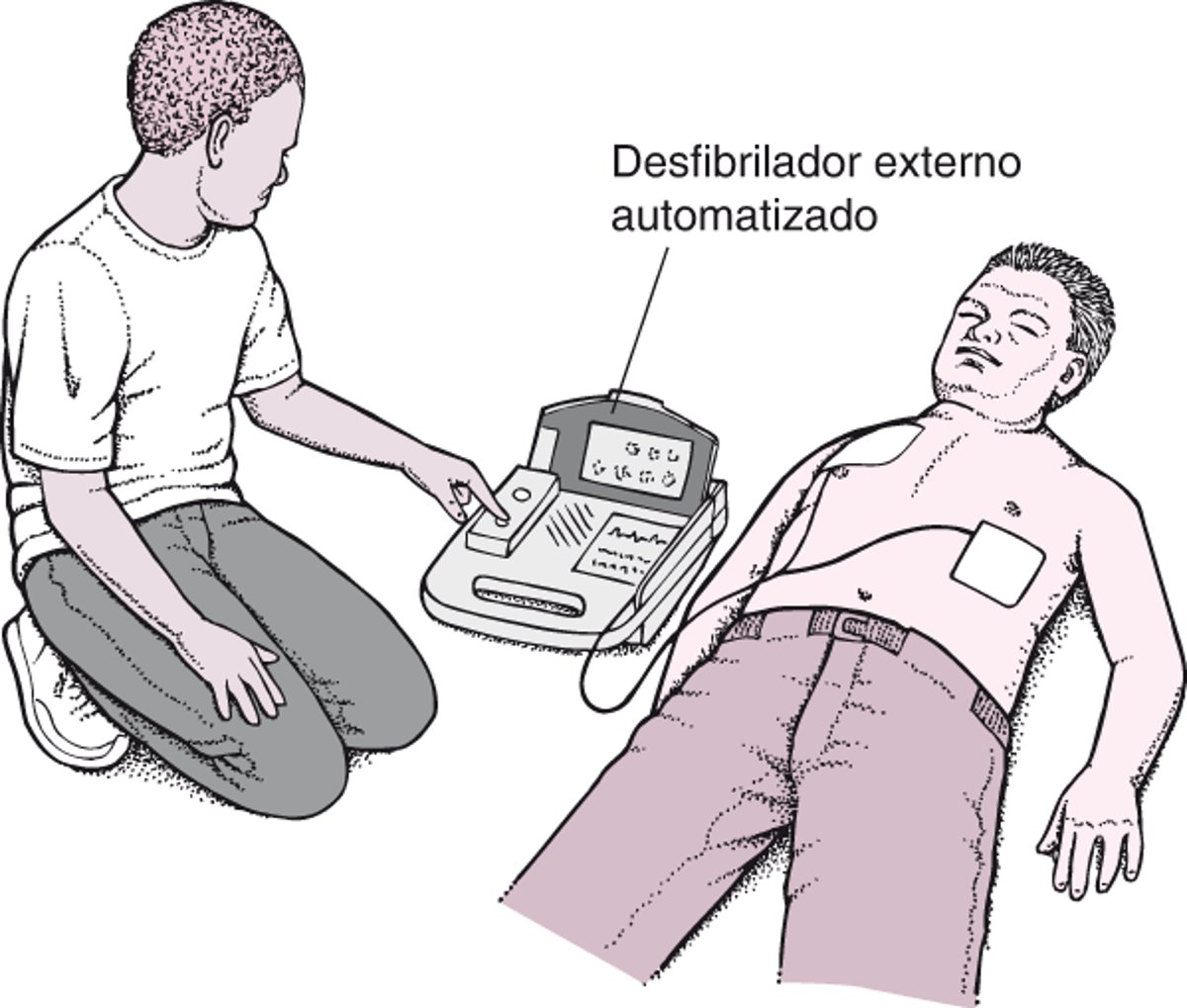 Desfibrilador externo automatizado: Impulsionar o coração
