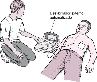 Desfibrilador externo automatizado: Impulsionar o coração