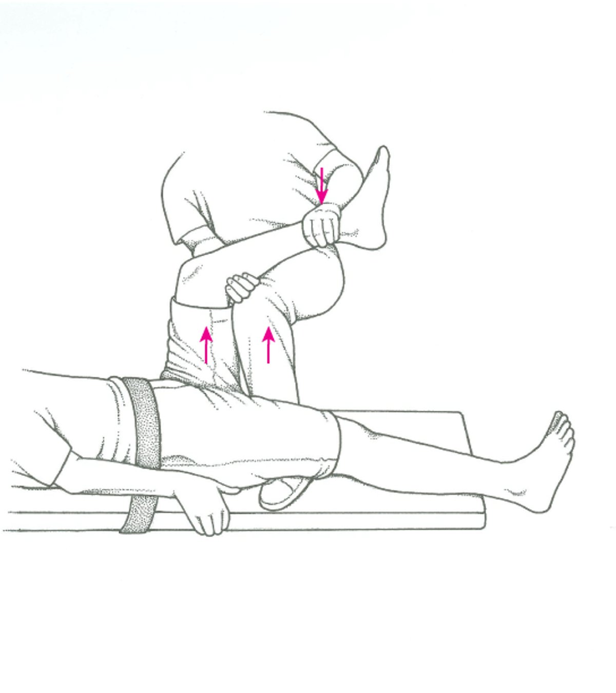 Reducción de una luxación de cadera: técnica del capitán Morgan