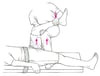 Reducing a Hip Dislocation: Captain Morgan Technique