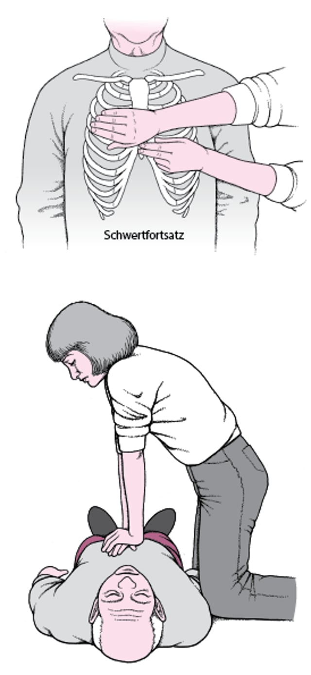 Herzdruckmassage bei einem Erwachsenen