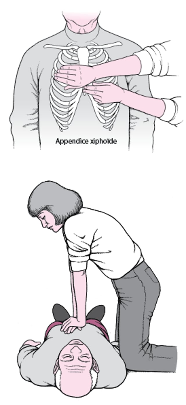 Pratiquer des compressions thoraciques chez un adulte