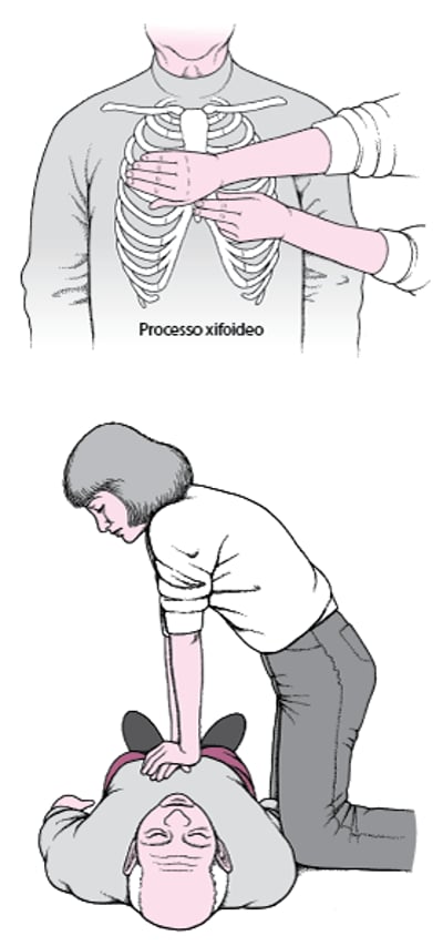 Come eseguire il massaggio cardiaco negli adulti