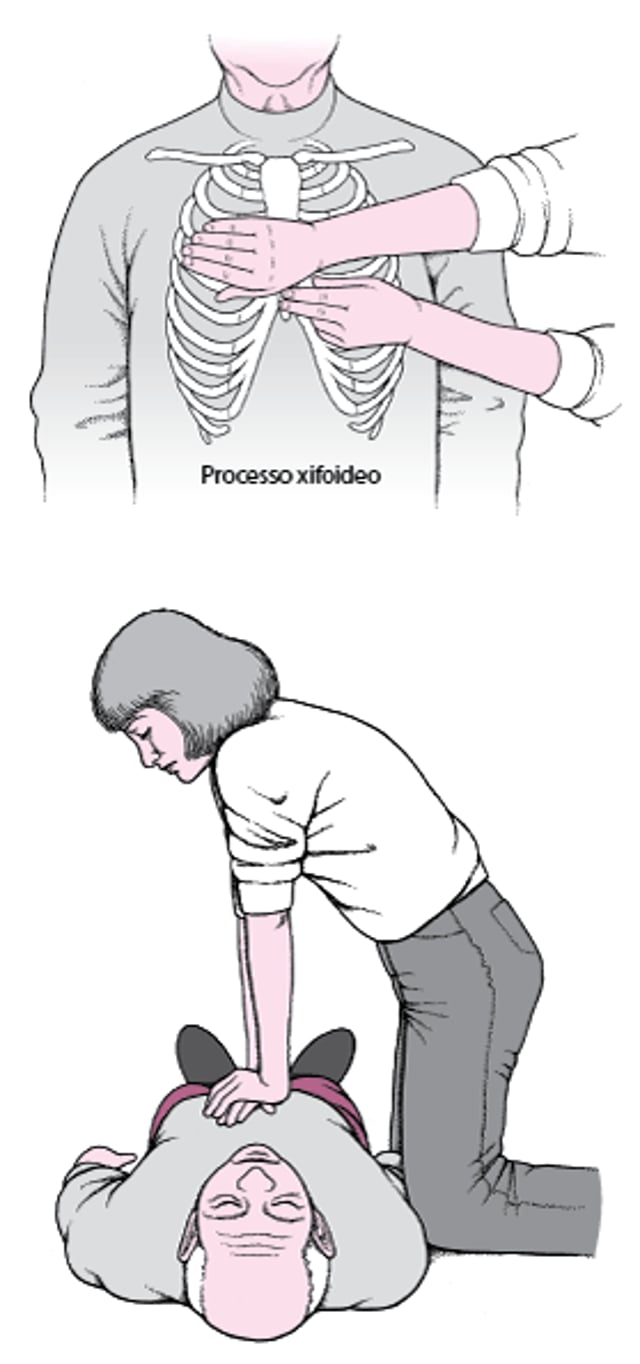Come eseguire il massaggio cardiaco negli adulti