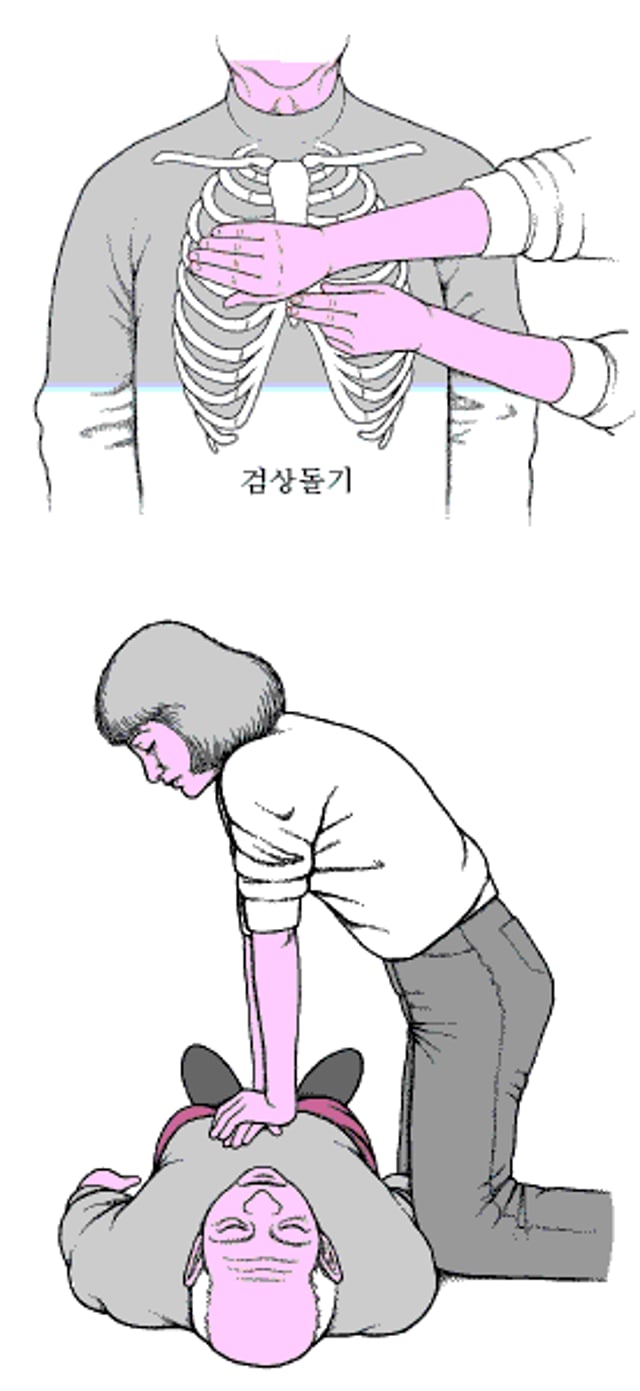 성인의 흉부 압박 실시