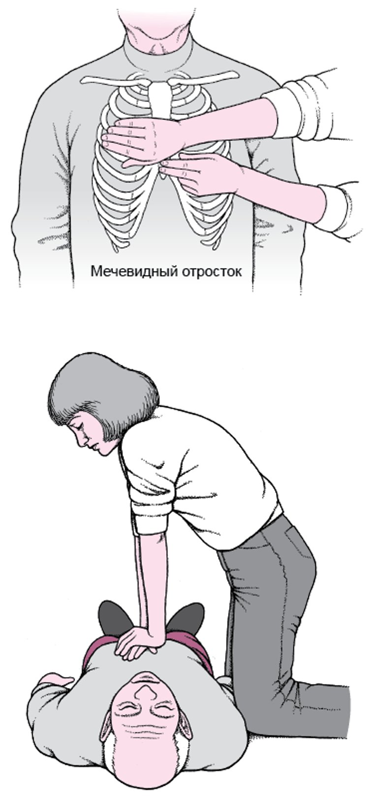 Выполнение непрямого массажа сердца взрослым