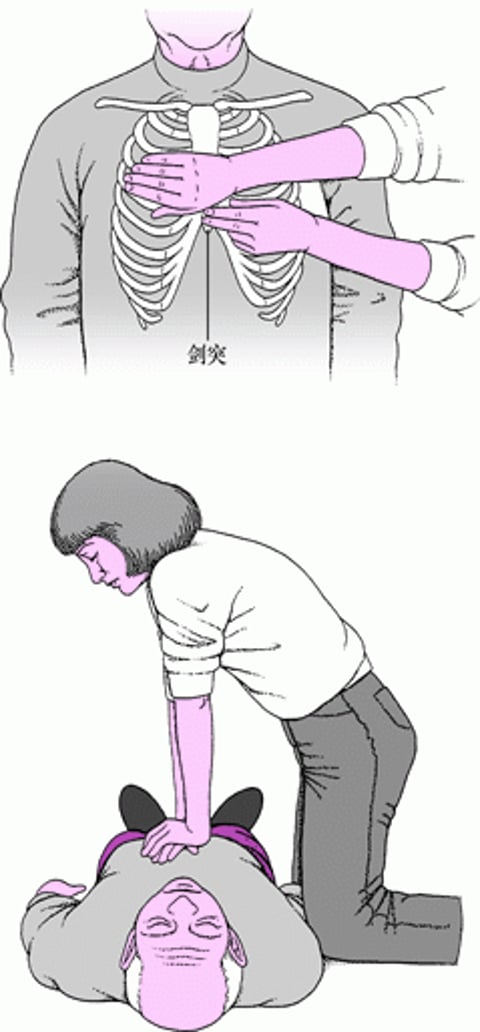 对成人进行胸外按压