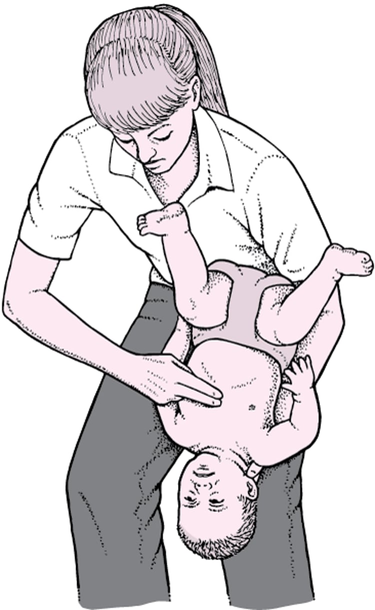 Dégagement des voies respiratoires chez les nourrissons