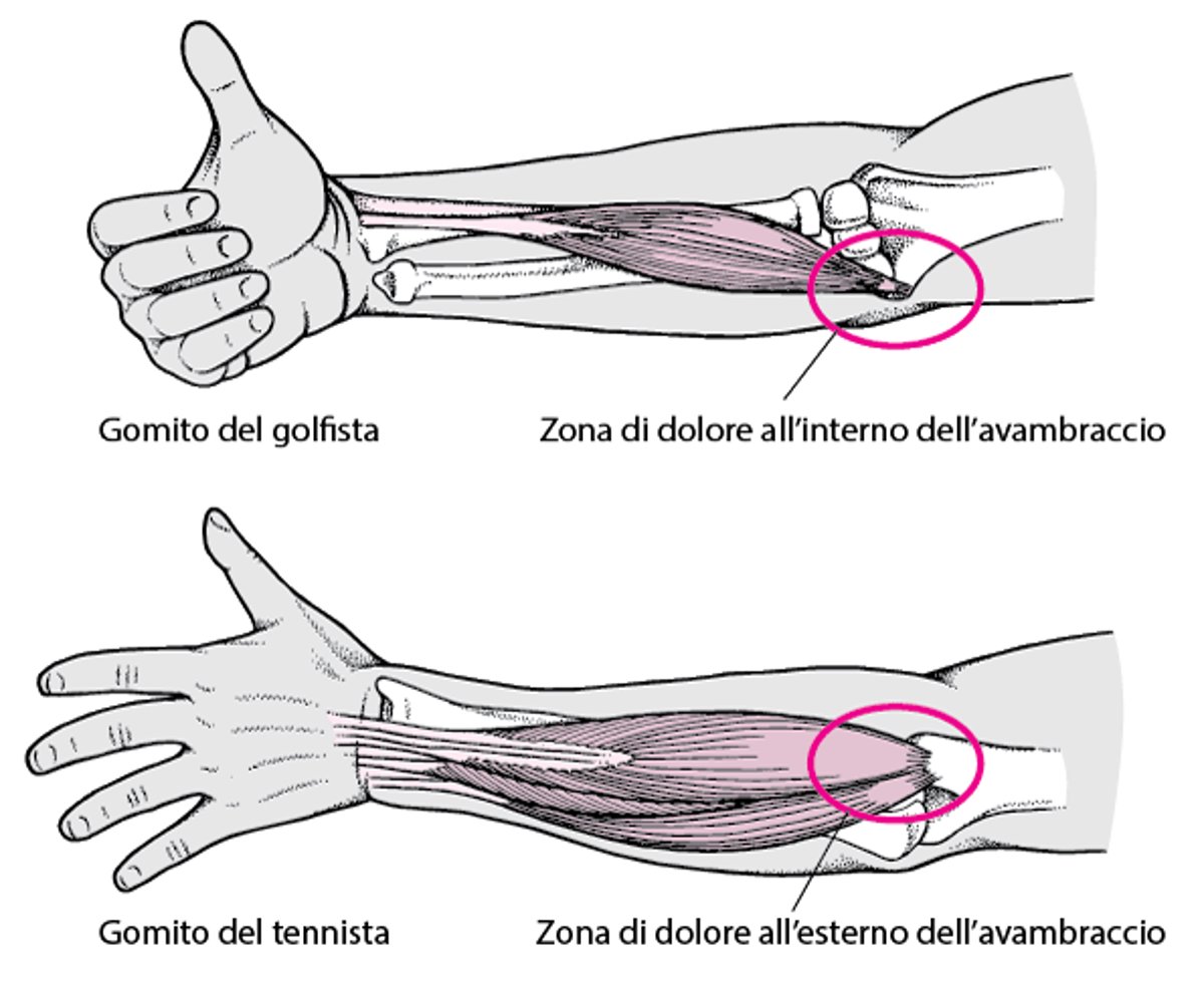 Quando il gomito fa male