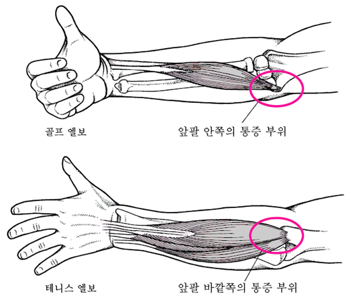 팔꿈치가 아플 때