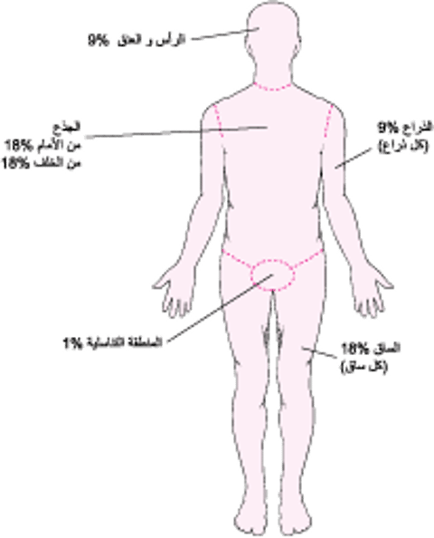 تقدير مدى الحَرق
