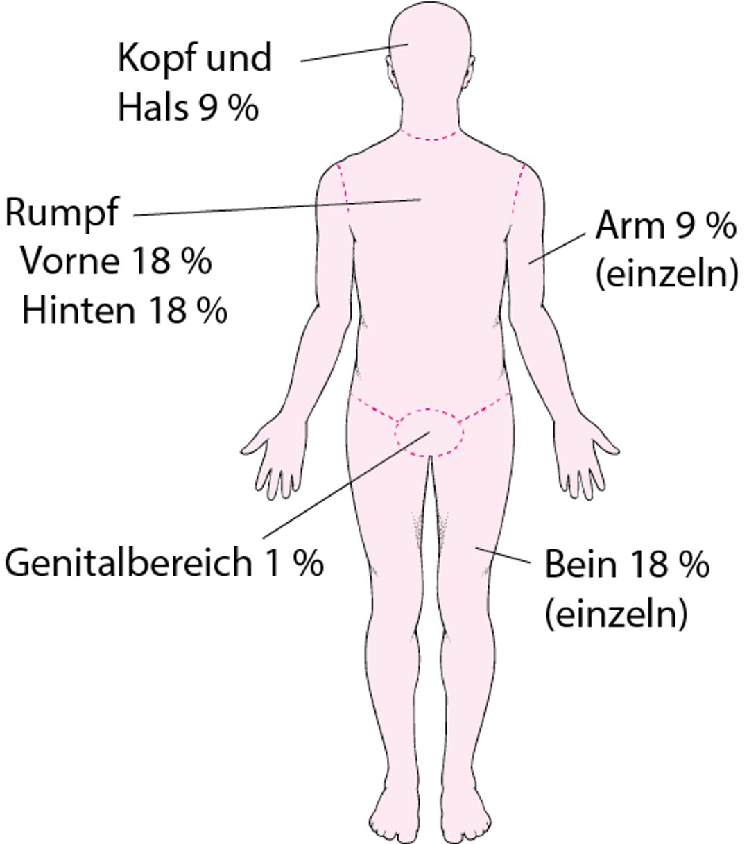 Das Ausmaß der Verbrennung abschätzen