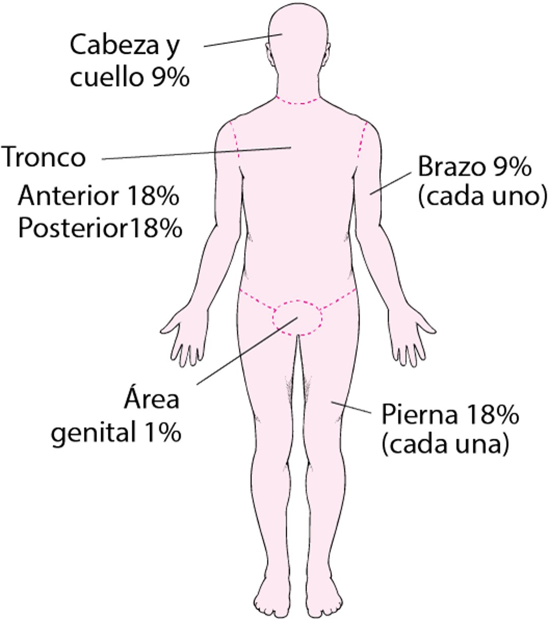 Calcular la extensión de una quemadura