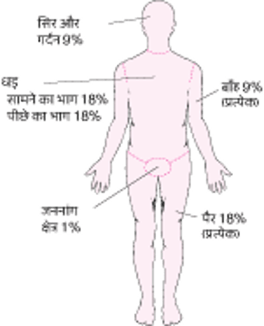 जलन की सीमा का आकलन करना