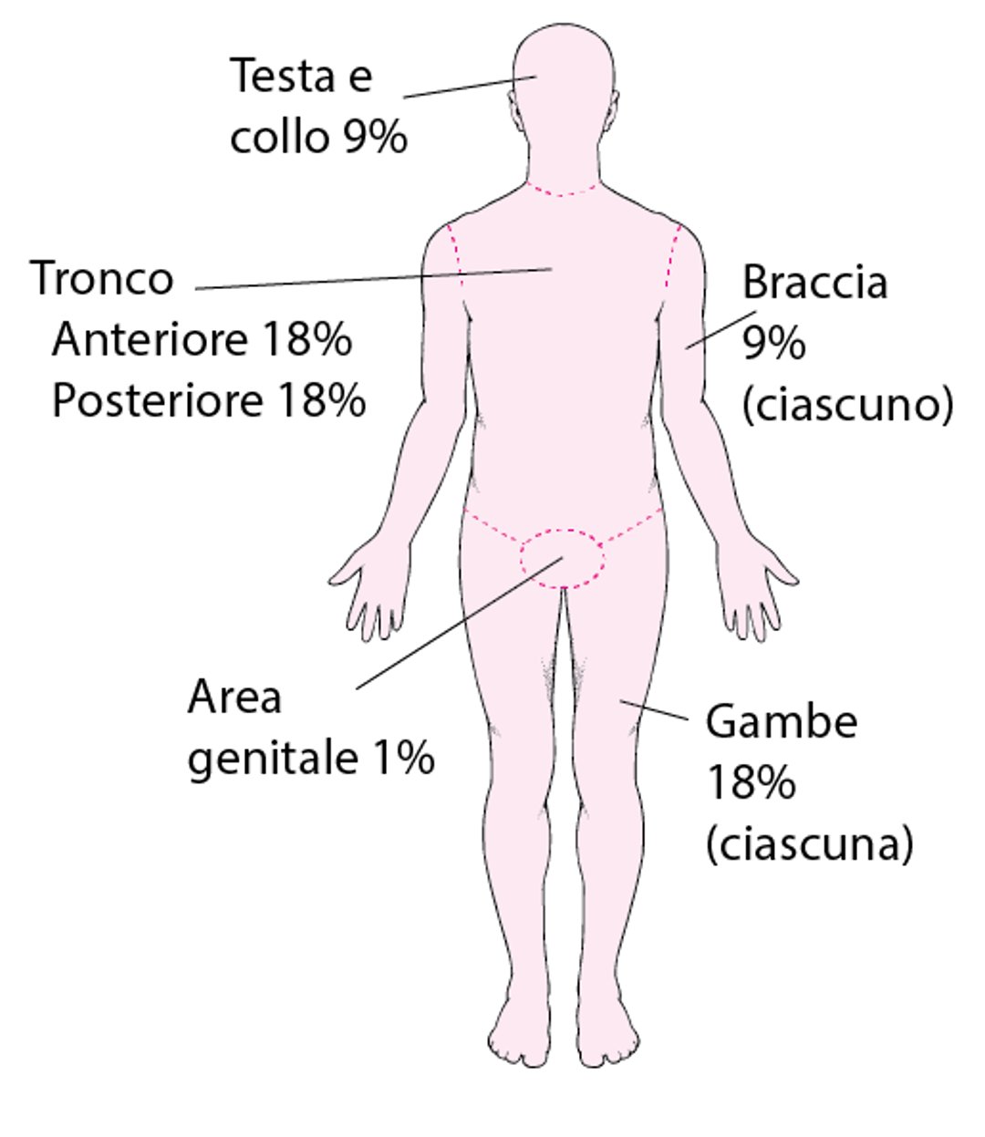 Valutazione dell’estensione dell’ustione