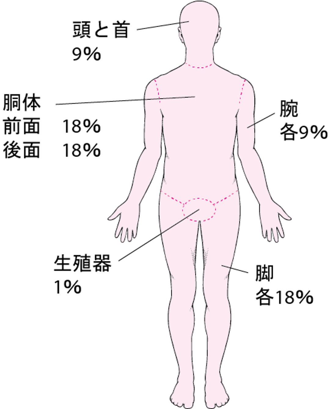 熱傷の範囲を推定する