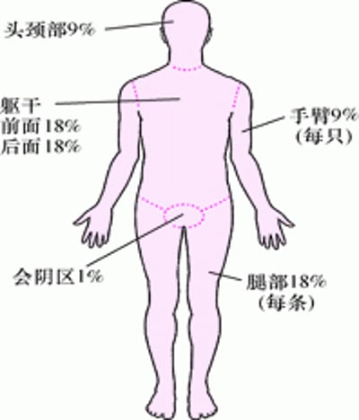 评估烧伤程度
