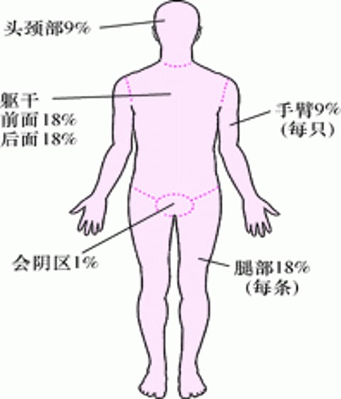 评估烧伤程度