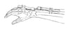 External Fixator