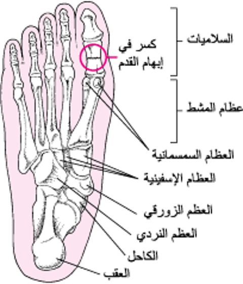 أين تحدث كسورُ القدم
