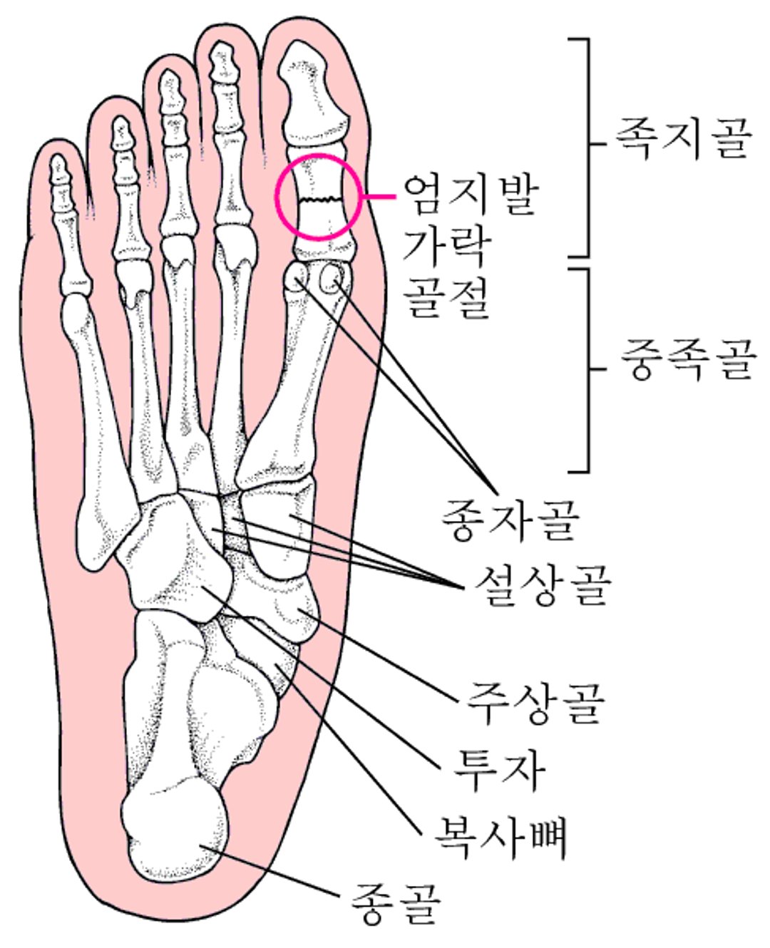 발 골절이 발생하는 부위