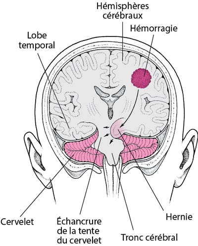 Engagement : le cerveau sous pression