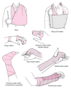 Commonly Used Techniques for Immobilizing a Joint