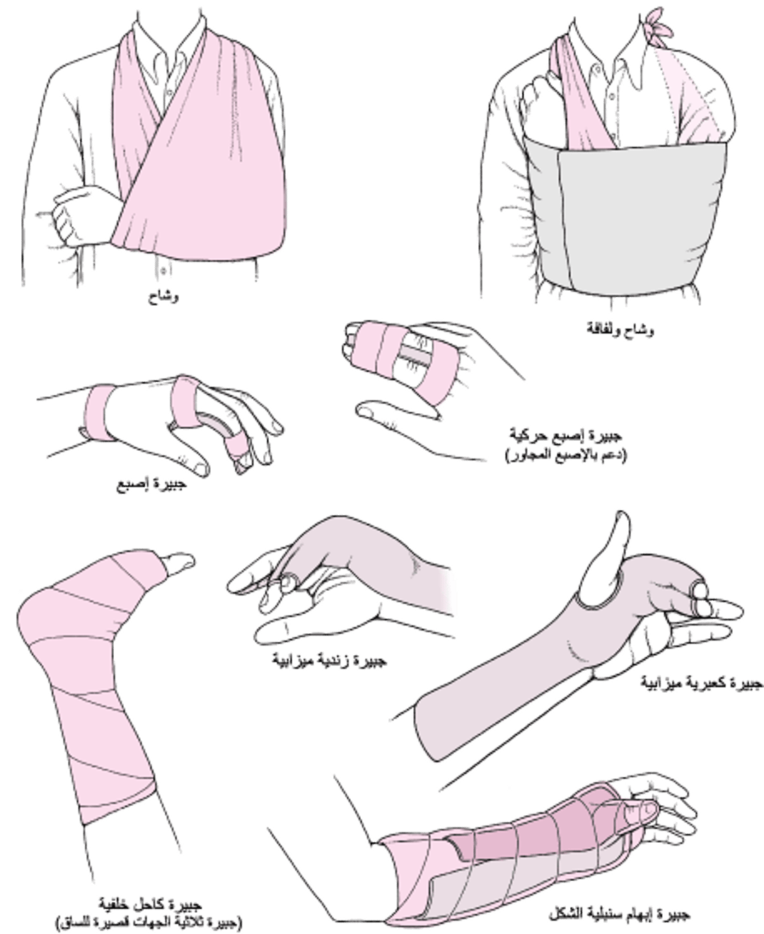 التقنياتُ الشائعة لتثبيت المفصل