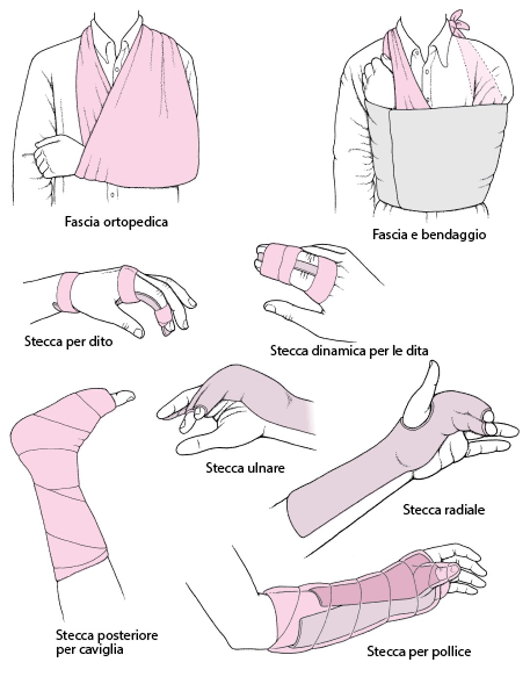 Tecniche per immobilizzare un’articolazione