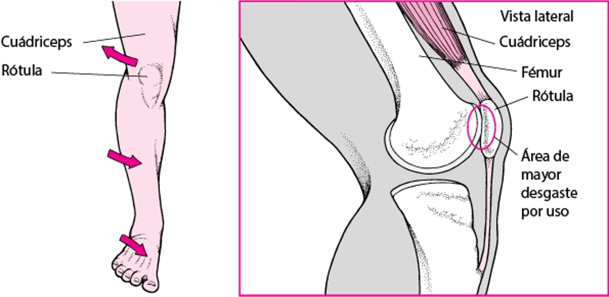 Cuando duele la parte anterior de la rodilla
